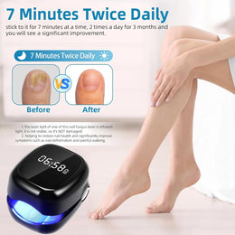 Nail Fungus Treatment LED Laser Device for Cleaning