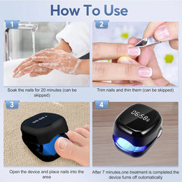 Nail Fungus Treatment LED Laser Device for Cleaning